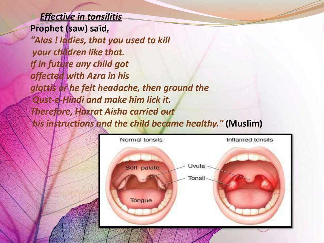 tibenabawi1-140330103317-phpapp01_Page_64