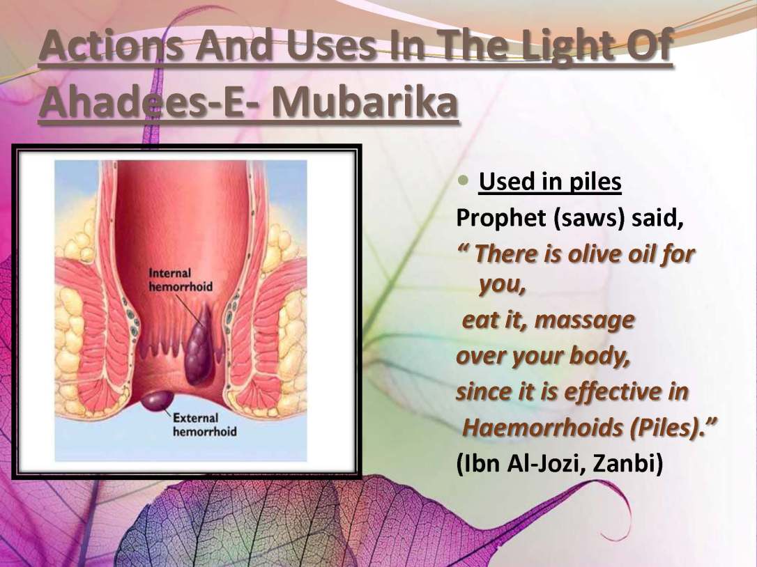 tibenabawi1-140330103317-phpapp01_Page_73